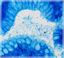 ピロリ菌の感染について