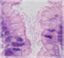ピロリ菌を見つける検査法